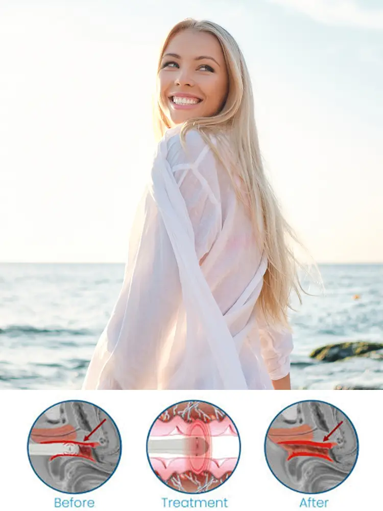 Causes of Vaginal Rejuvenation Concerns